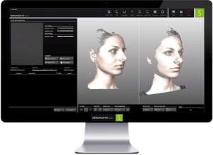 Computer monitor showing Zirkonzahn 3-D scan of female face for a Smile Now digital smile design