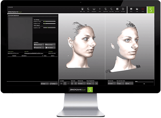 Computer monitor showing Zirkonzahn 3-D scan of female face for a Smile Now digital smile design