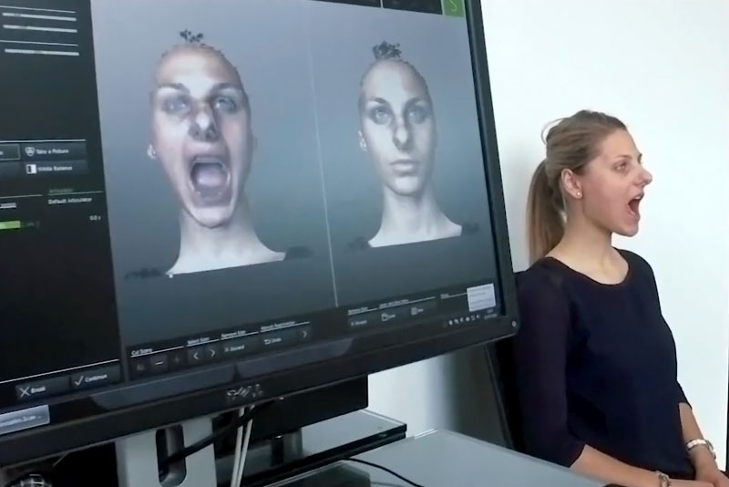 Female patient undergoing digital smile design scan.