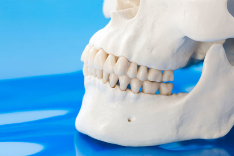 Zygomatic Dental Implants Phoenix, AZ Cheek Bone Dental Implants