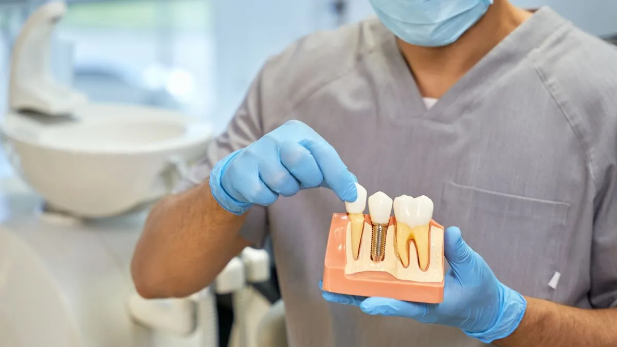 Dentist Holding A Model Of A Dental Implant