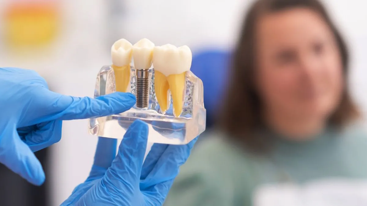 Dentist's Hand Holding A Model Of Dental Implant