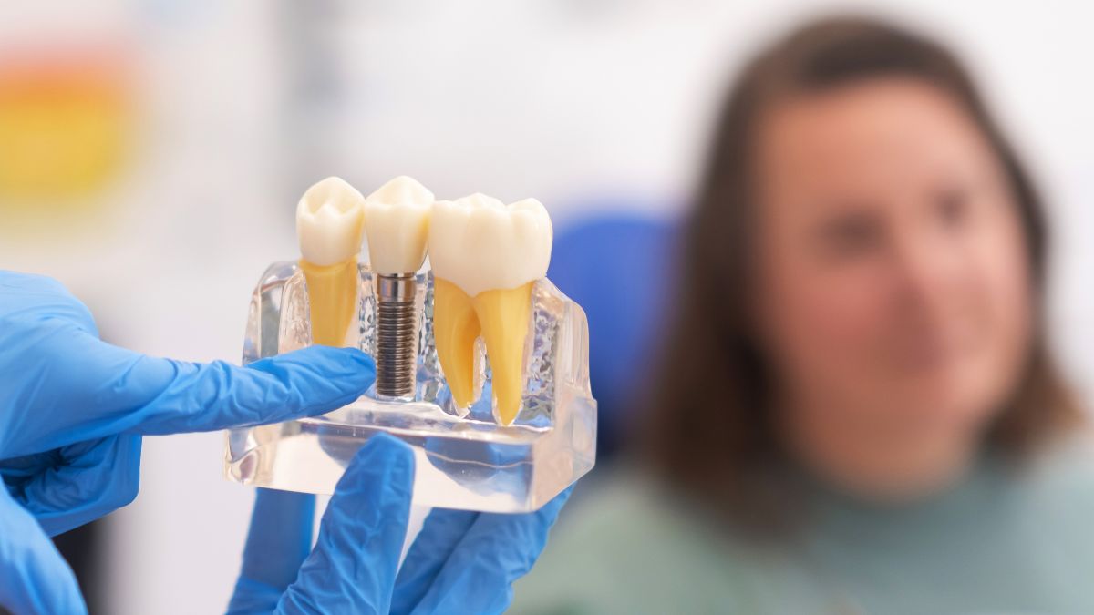 Dispelling the Myths: The Truth About Phoenix Dental Implants