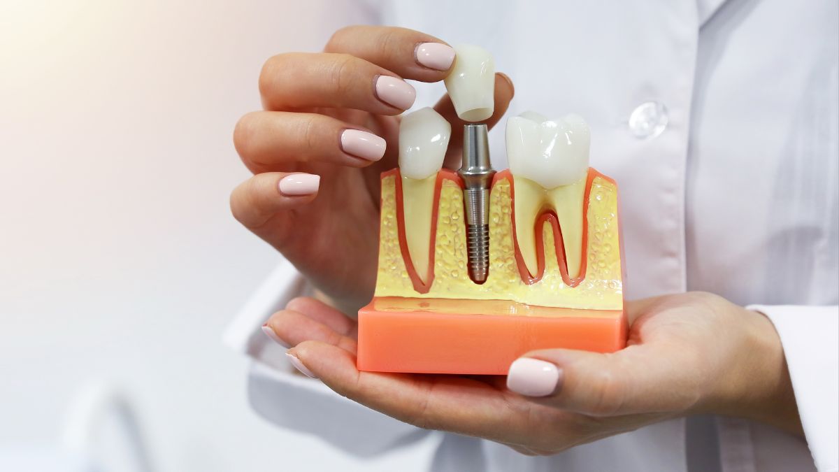 The Fabric of Dental Restorations: Exploring Implant Materials in Scottsdale, AZ