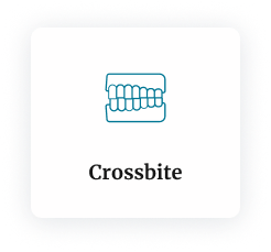 Icon of misaligned teeth labeled Crossbite at Smile Now Arizona.