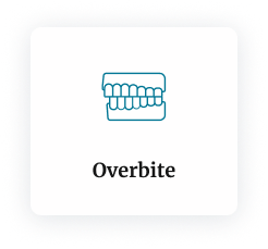 Icon of teeth with an overbite, Overbite text below, brought to you by Smile Now Arizona.